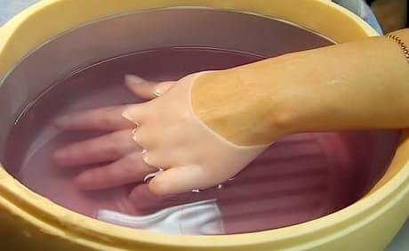 Как лечить артрит на пальцах рук