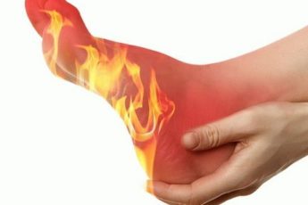 Причины и лечение горящих ступней ног