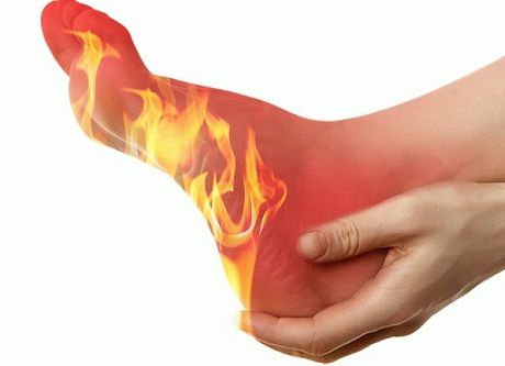 Причины и лечение горящих ступней ног