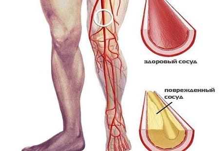 Улучшение кровообращения в ногах